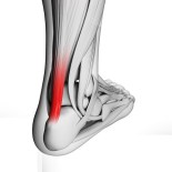 18448338 - 3d rendered illustration of the achilles tendon